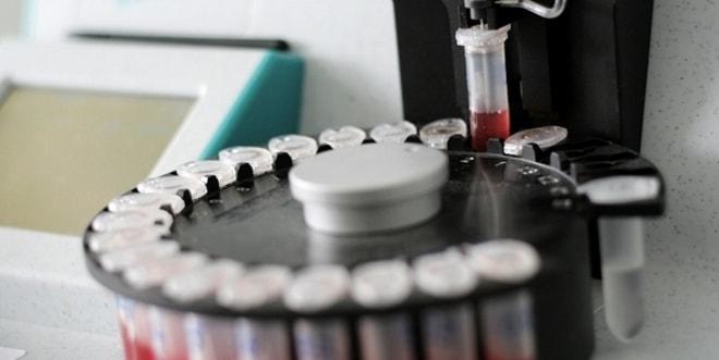 Сдача анализов на гормоны после овуляции