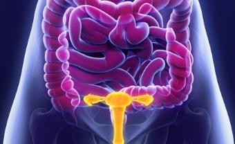 Проявление апоплексии яичника с правой или с левой стороны