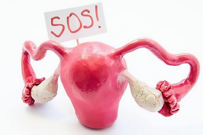 Женские яичники атрофированы