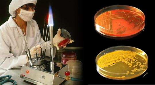 Как проводится бактериологическое исследование