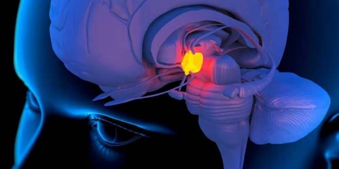 Дисфункция гипоталамо-гипофизарной системы Изменения в гипоталамо-гипофизарной системе