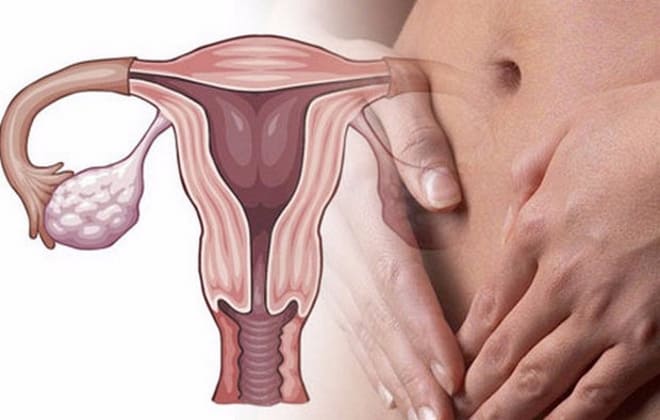 Развитие двухстороннего оофорита