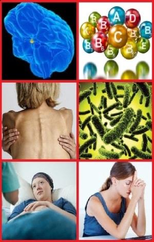 Фотоколлаж факторов влияющих на вторичную яичниковую недостаточность