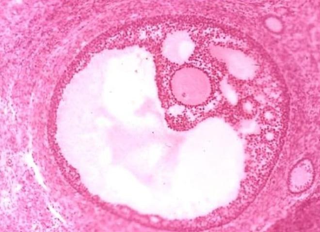 Фото граафова пузырька