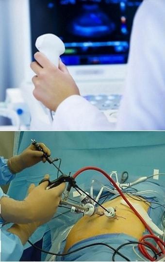 УЗИ и лапароскопия