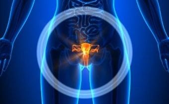 Компьютерная томография яичников