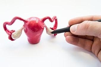 Обязательное удаление кисты яичника