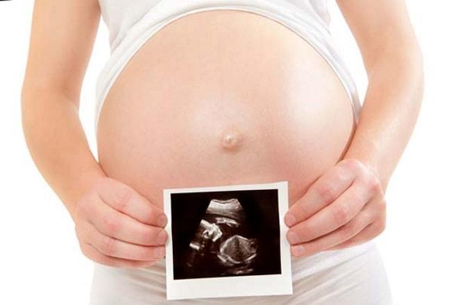 Киста придатка матки при беременности у женщин