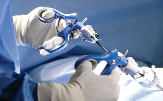 Аднексэктомия лапароскопическим способом