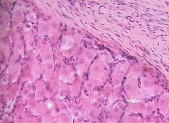 Лютеиновые клетки на фото