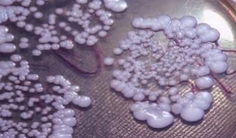 Молочница у женщины бальзаковского возраста