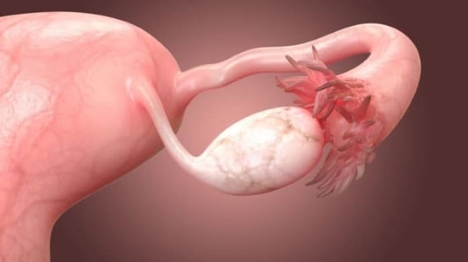 Как посчитать объём яичника