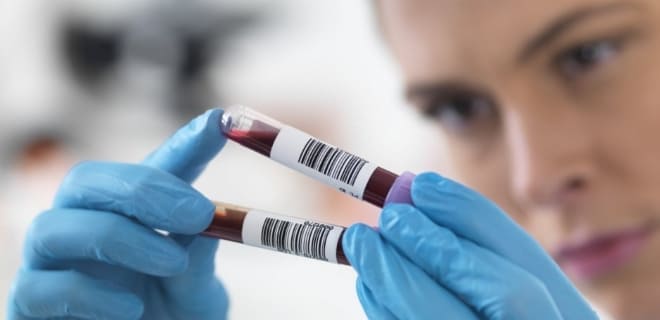 Анализы на ФСГ