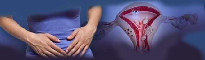 Фото перекрученной кисты яичника