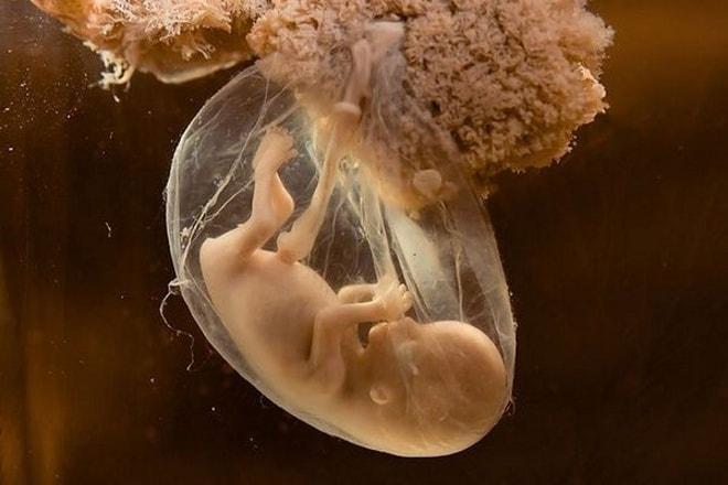 Как замирает плод в утробе матери