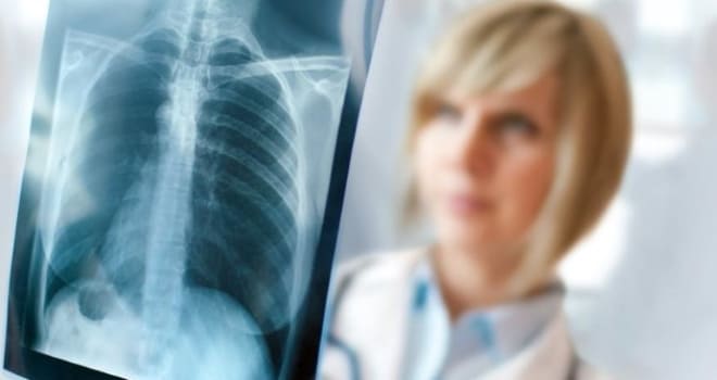 Флюрография лёгких при двухстороннем оофорите