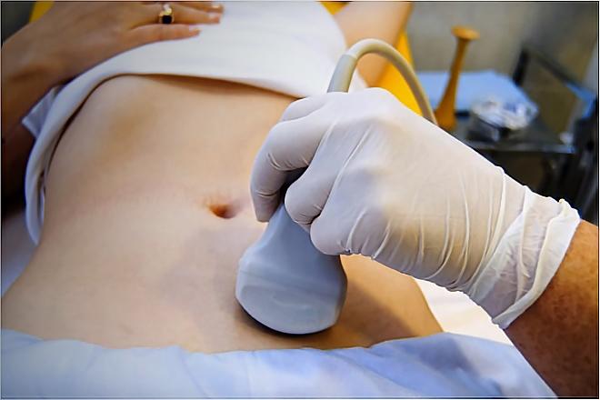 Ультразвуковое исследование придатков матки