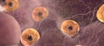 Фолликулы на фото