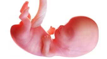 Нарушение развития внутриутробного развития