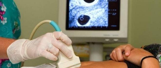 УЗИ для определения гипоэхогенного образования