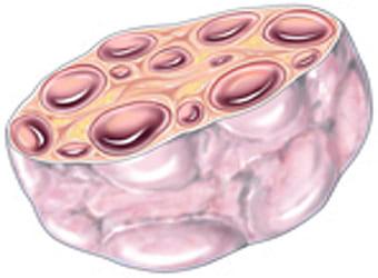 Поликистозный яичник в разрезе