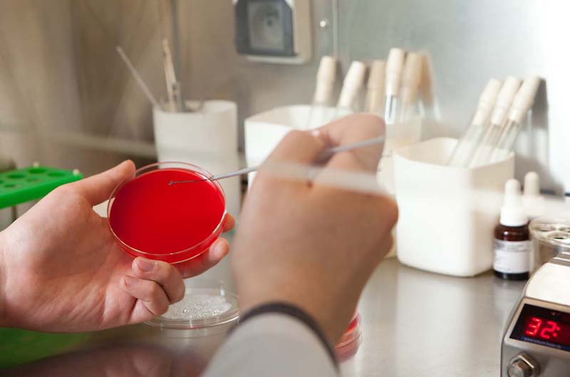 Диагностика мокроты при ба