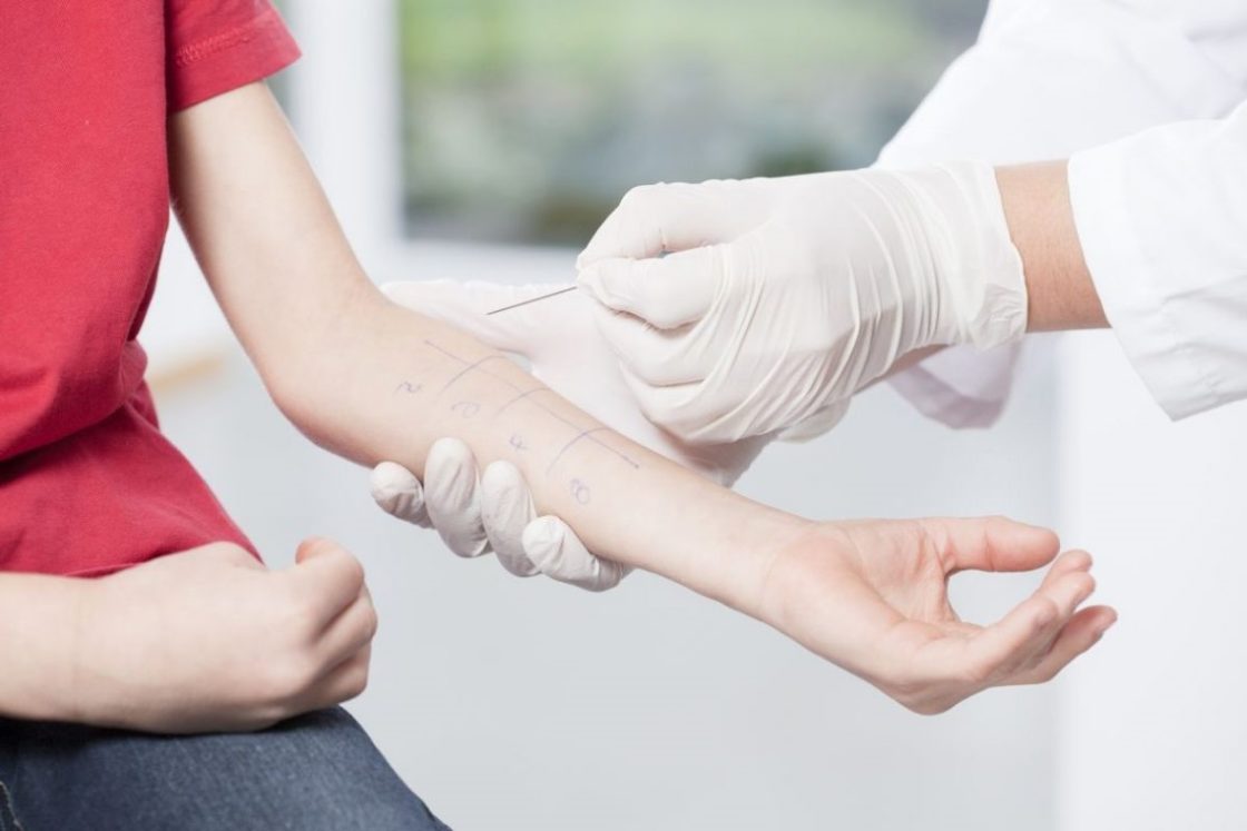 анализы на аллергены