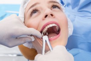 Современные способы удаления коренных зубов